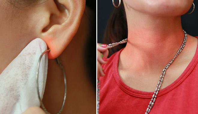 Cảm nhận khi đeo bạc giả bị dị ứng