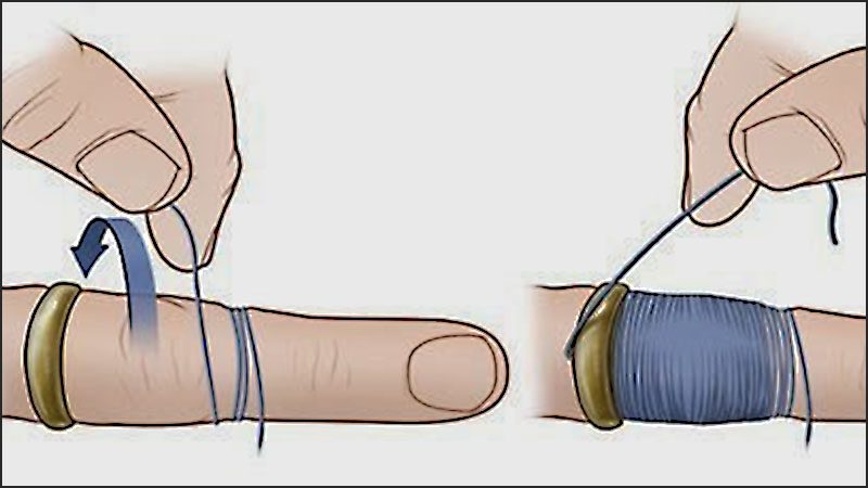 Hướng dẫn cách tháo nhẫn bằng chỉ
