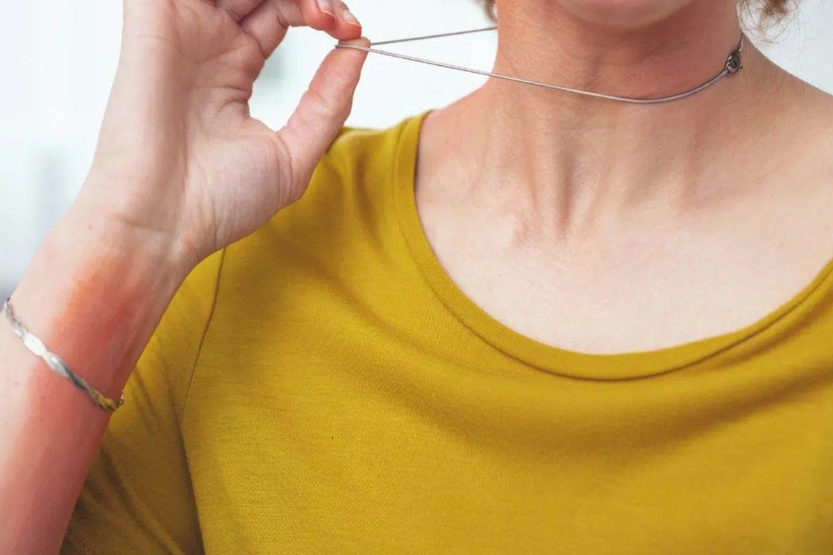 Tại sao đeo vàng bị ngứa?